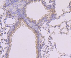 MLKL, p Ser345 Antibody (JM92-37), Novus Biologicals 100&mu;L:Antibodies,